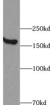 ZFYVE16 Antibody