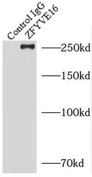 ZFYVE16 Rabbit Polyclonal Antibody