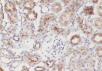 ZFYVE16 Rabbit Polyclonal Antibody
