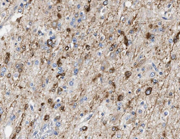 ZNF124 Rabbit Polyclonal Antibody