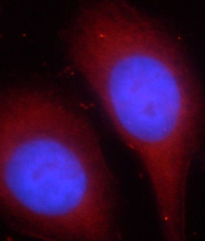 ZNF140 Rabbit Polyclonal Antibody