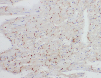 ZNF146 Rabbit Polyclonal Antibody