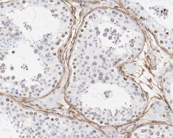 ZNF174 Rabbit Polyclonal Antibody