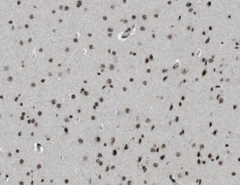 ZNF18 Rabbit Polyclonal Antibody