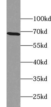 ZNF211 Antibody