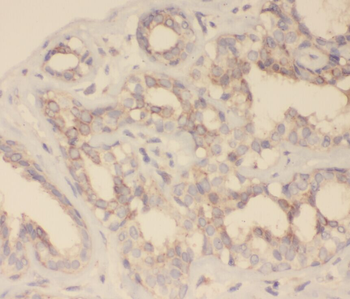 ZNF24 Rabbit Polyclonal Antibody