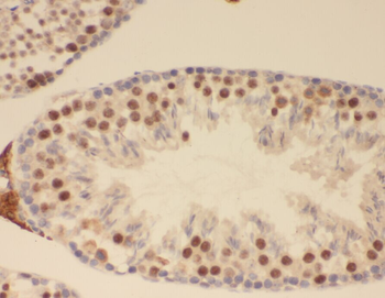 ZNF311 Rabbit Polyclonal Antibody