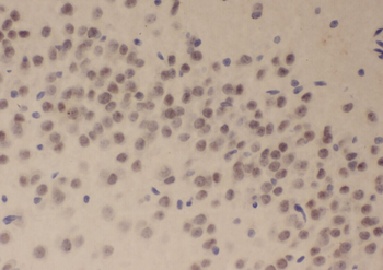 ZNF34 Rabbit Polyclonal Antibody