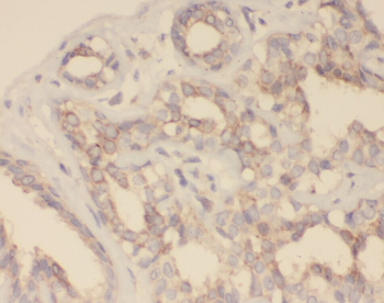 ZNF395 Rabbit Polyclonal Antibody