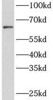 ZNF571 Antibody