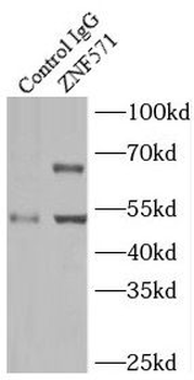 ZNF571 Rabbit Polyclonal Antibody