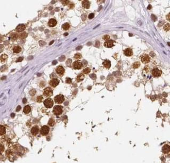 ZNF571 Rabbit Polyclonal Antibody