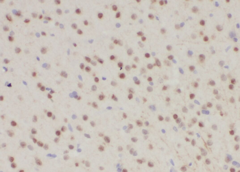 ZNF597 Rabbit Polyclonal Antibody