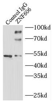 ZNF606 Rabbit Polyclonal Antibody