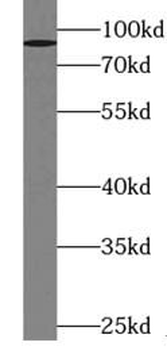 ZNF746 Antibody