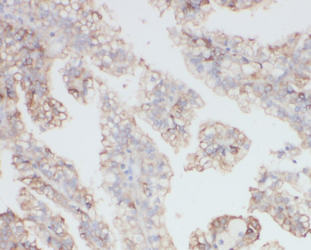 ZNF839 Rabbit Polyclonal Antibody