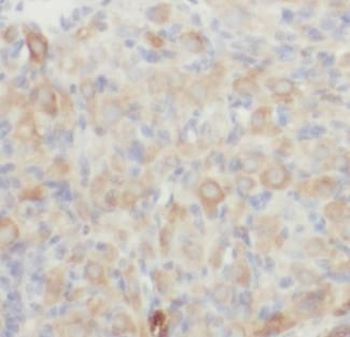 ZP3 Rabbit Polyclonal Antibody