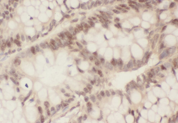 ZWILCH Rabbit Polyclonal Antibody