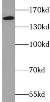 ZZZ3 Antibody