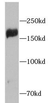 IRS2 Rabbit Polyclonal Antibody