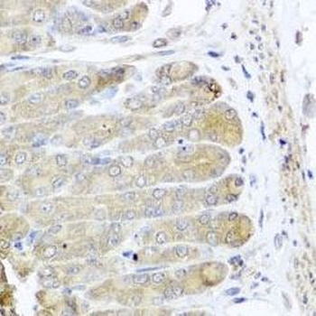 IRS2 Rabbit Polyclonal Antibody