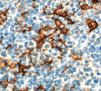 CD163 Rabbit Polyclonal Antibody
