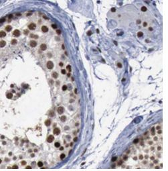 STAG3 Rabbit Polyclonal Antibody