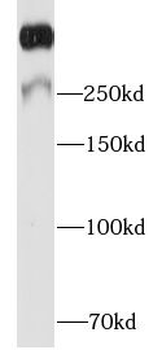MKI67 Antibody