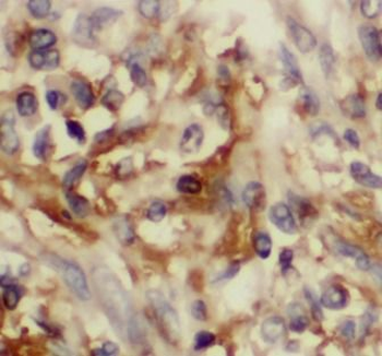 CCL20 Antibody