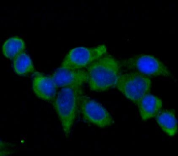 VCL Mouse Monoclonal Antibody