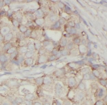 VCL Mouse Monoclonal Antibody