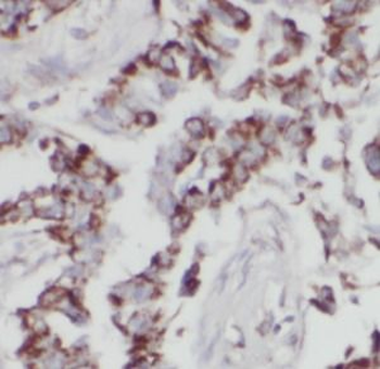 LIF Rabbit Polyclonal Antibody
