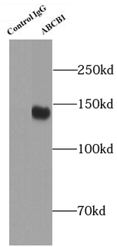 ABCB1 Rabbit Polyclonal Antibody