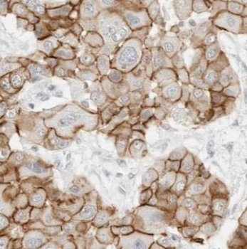 ABCB1 Rabbit Polyclonal Antibody