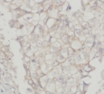 ABCC1 Rabbit Polyclonal Antibody