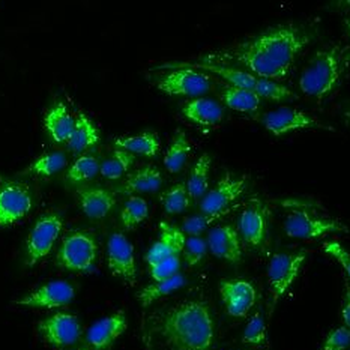 TSHB Rabbit Polyclonal Antibody