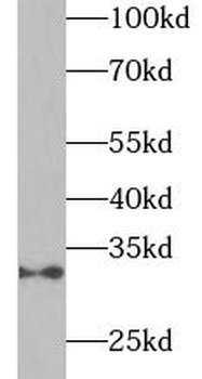 ADIPOQ Rabbit Polyclonal Antibody