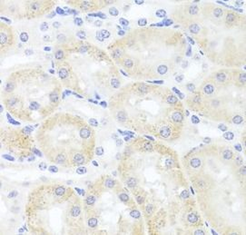 ADIPOQ Rabbit Polyclonal Antibody