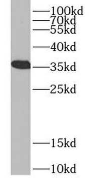 VDAC1 Rabbit Polyclonal Antibody