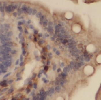 VDAC1 Rabbit Polyclonal Antibody