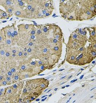 THBS2 Rabbit Polyclonal Antibody