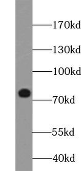 MAP3K3 Antibody