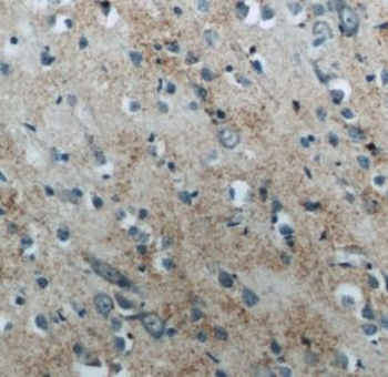 NPPB Antibody