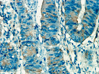 GIP Rabbit Polyclonal Antibody