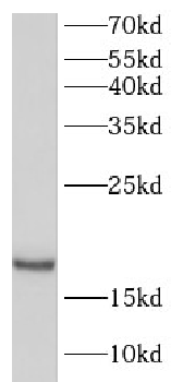 GIP Rabbit Polyclonal Antibody