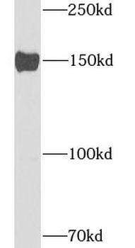 ATP7B Antibody