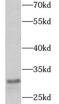CD8A Rabbit Polyclonal Antibody