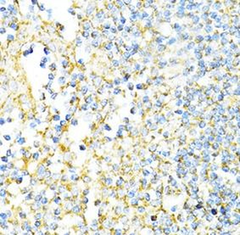 CD8A Rabbit Polyclonal Antibody