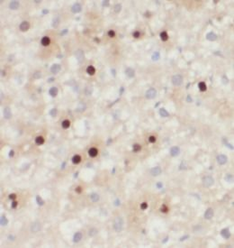 GSTP1 Rabbit Polyclonal Antibody