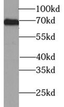 TYR Rabbit Polyclonal Antibody